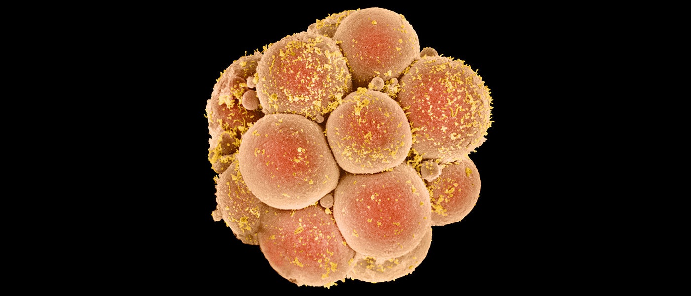 gene editing human gene editing crispr