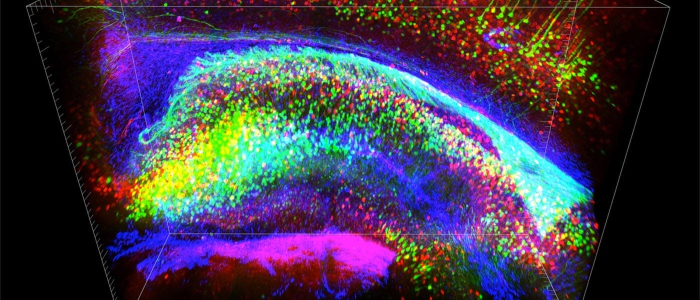 transparent brain neural imaging karl diesseroth optogenetics