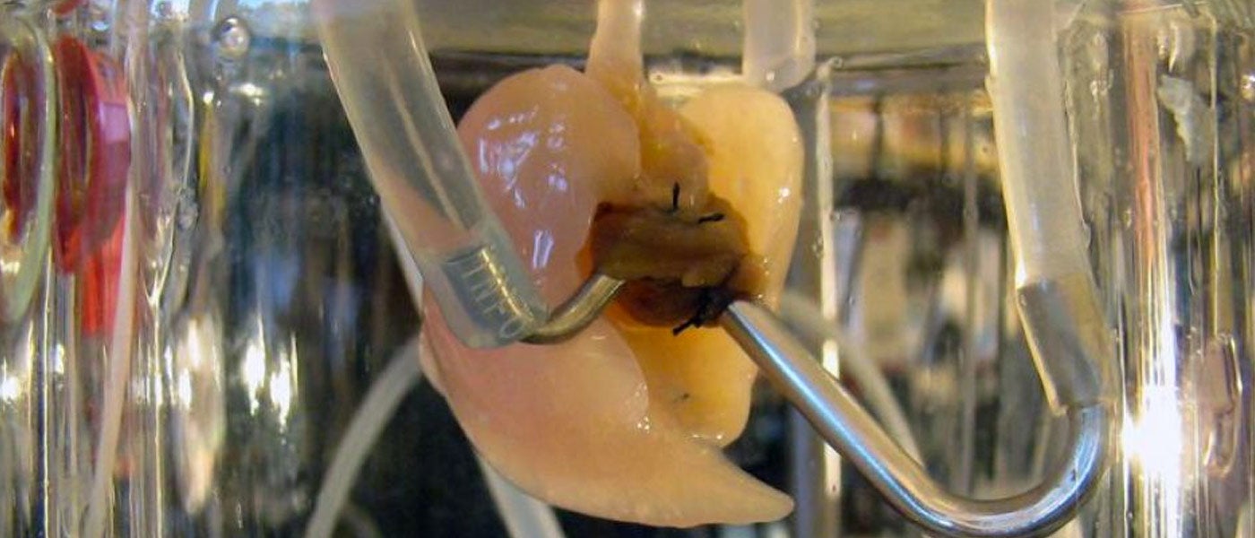 lung organoid idiopathic pulmonary fibrosis lab-grown lungs