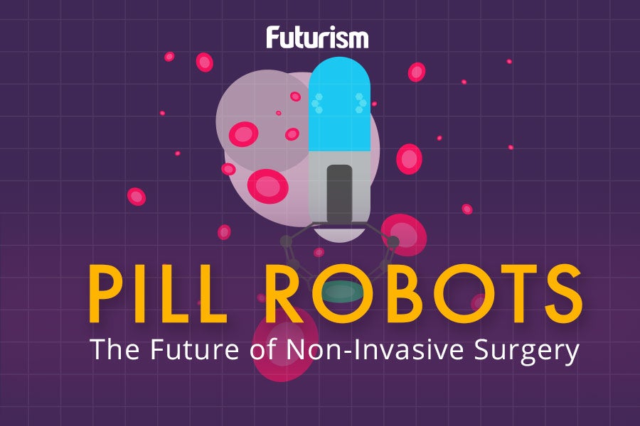 Pill Robots: The Future of Non-Invasive Surgery [INFOGRAPHIC]