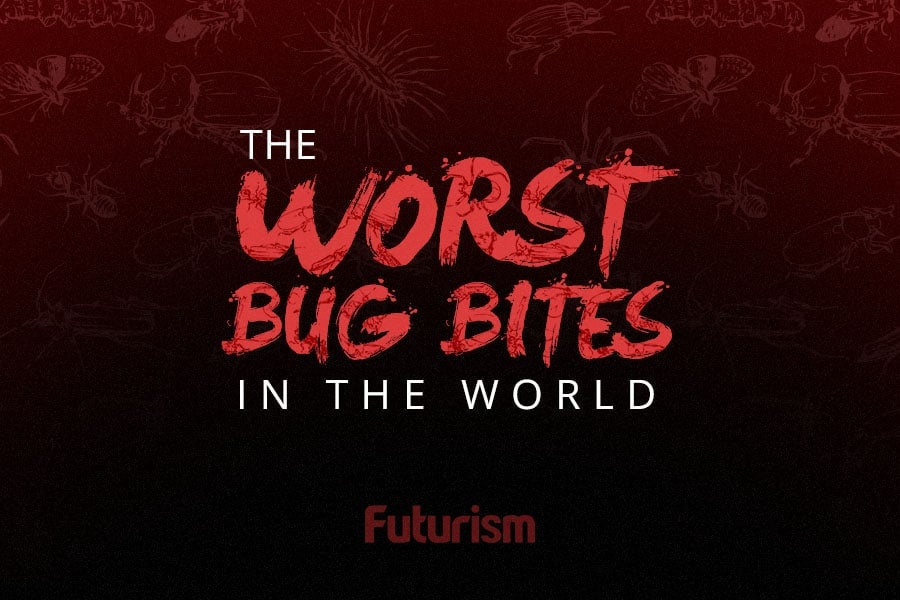 The Worst Bug Bites in the World [INFOGRAPHIC]
