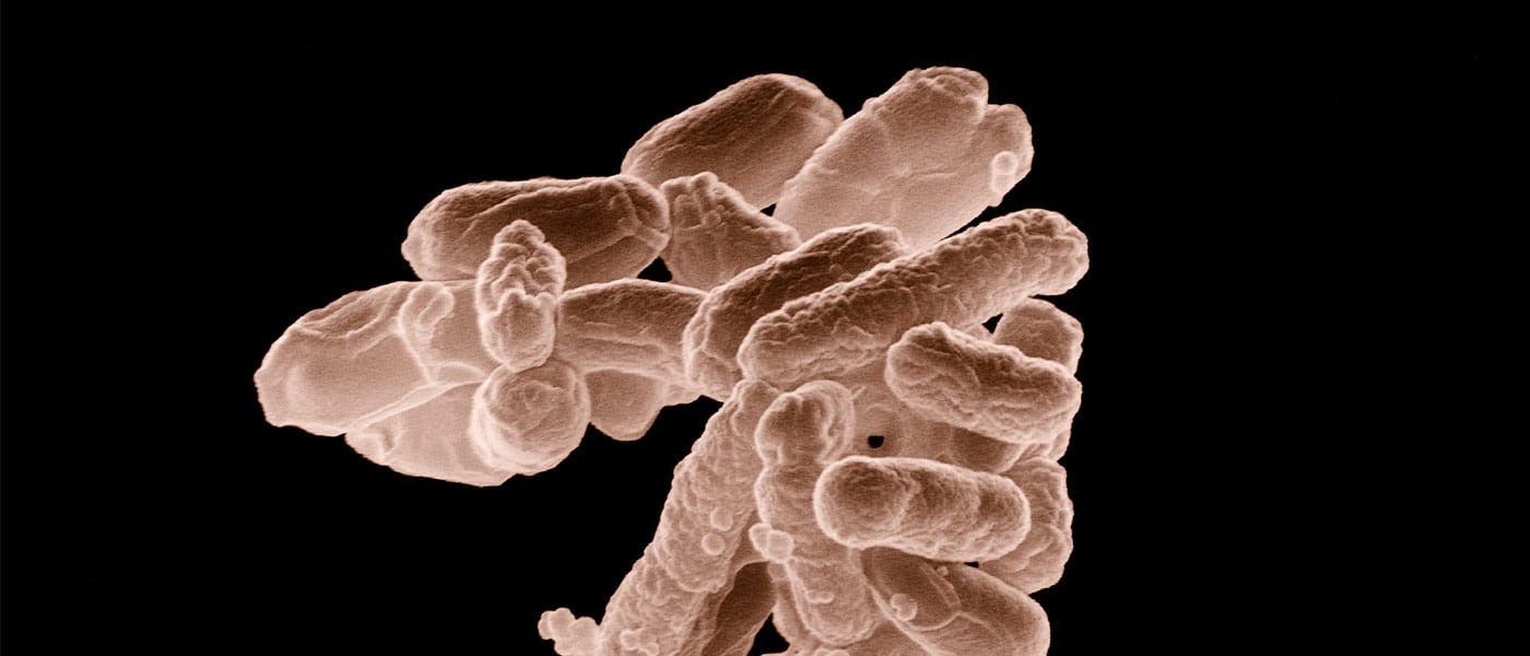 e coli genetic modification metabolism disorder