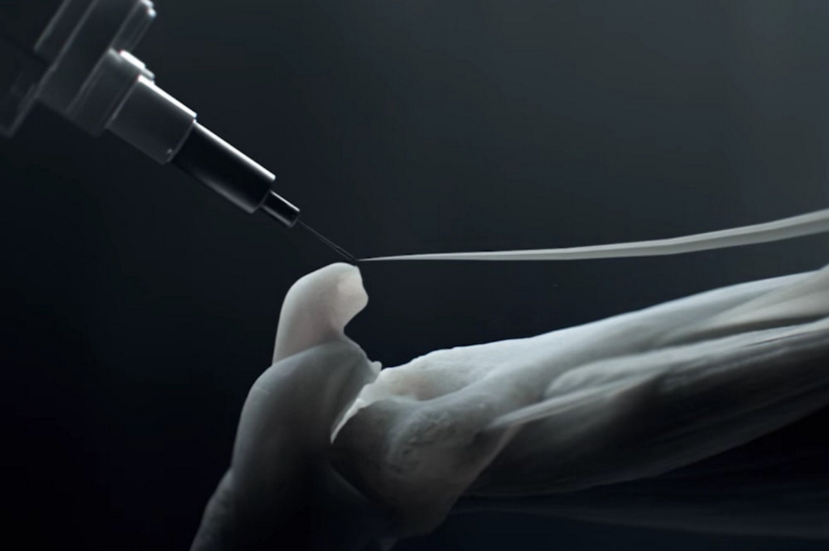 nylon artificial muscle robots