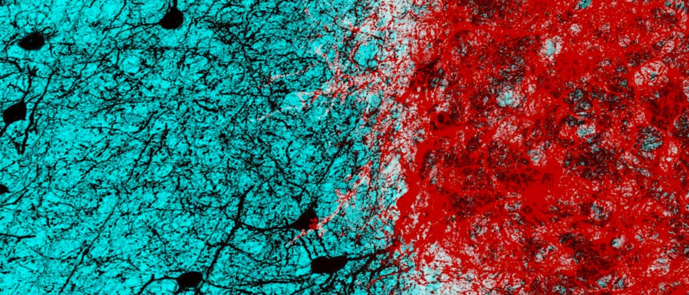 interneurons fear biology