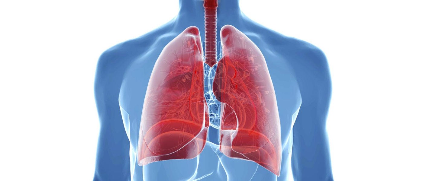 artificial lung cystic fibrosis medical technology