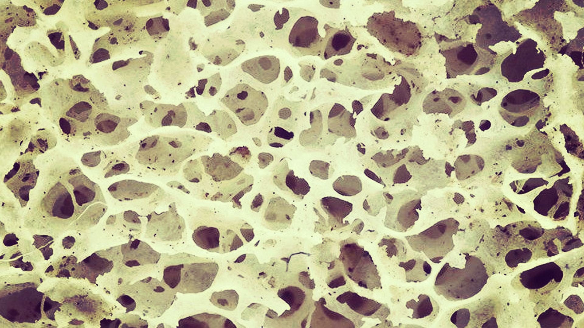 smart fabric periosteum materials engineering bioengineering