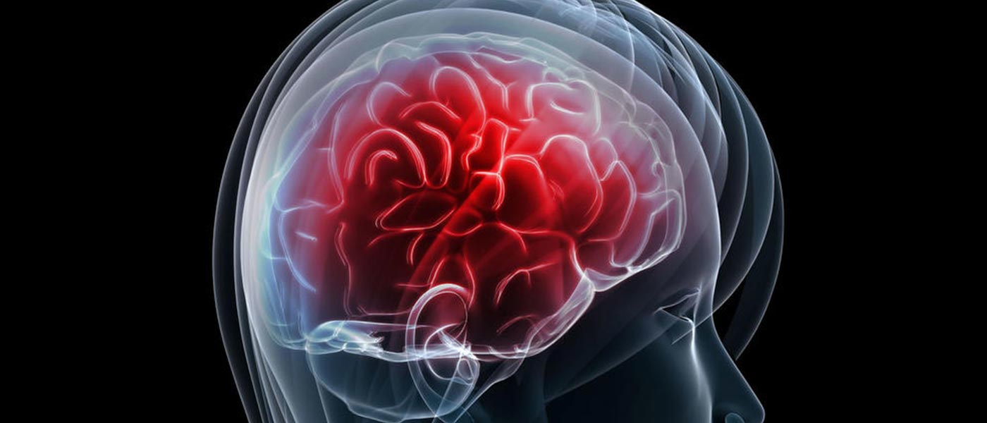genetic disorders brain health neuroscience cognitive ability