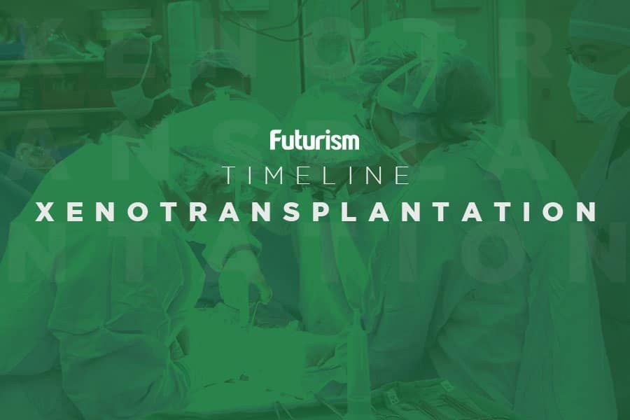 Xenotransplantation