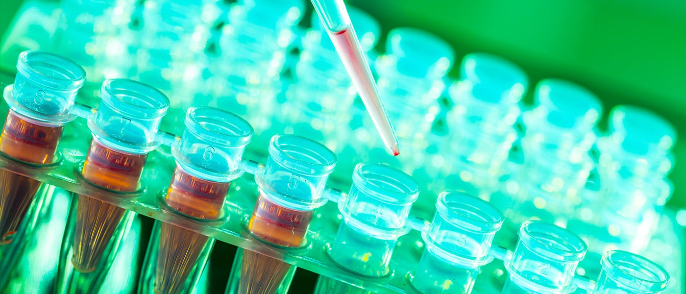 gene therapy sickle cell disease stem cells