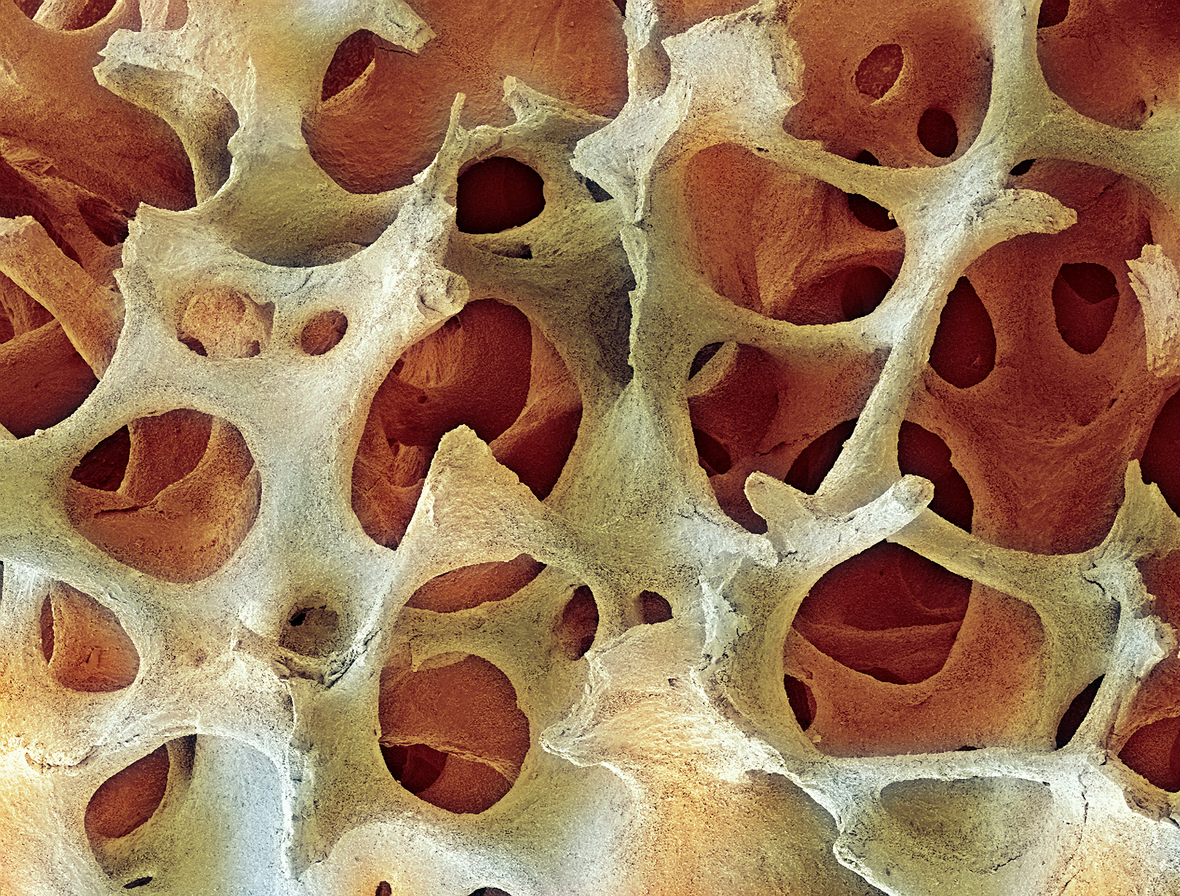 regrowing bone bone grafting bmp9 protein cell harvesting