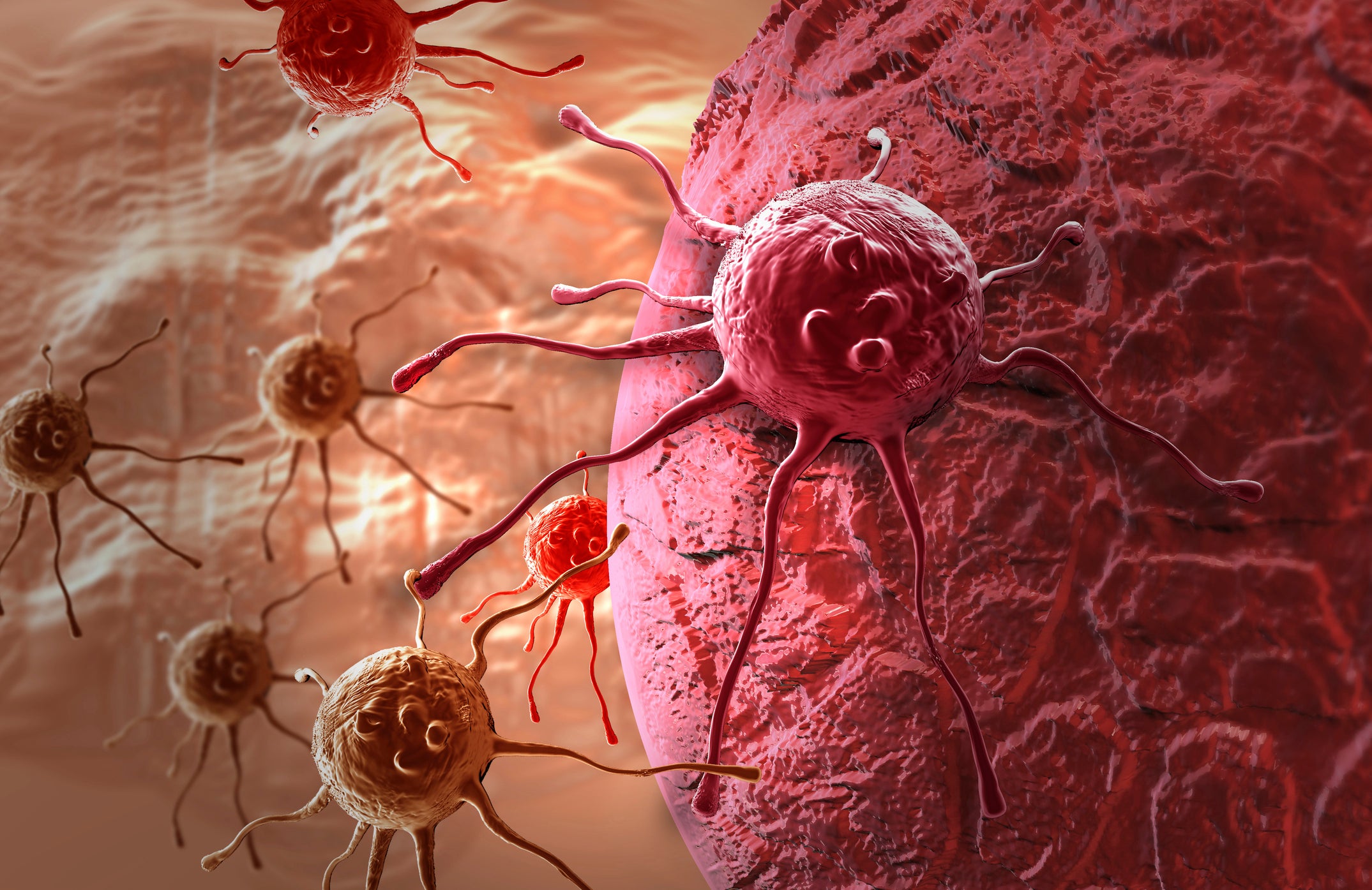 breast cancer trial her2