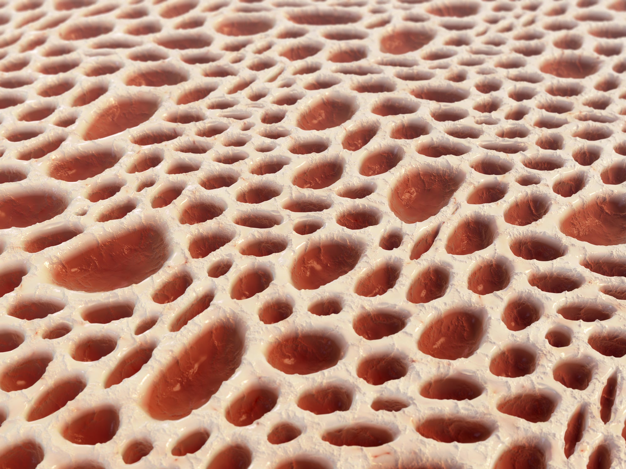 bone marrow medical implants blood disorders