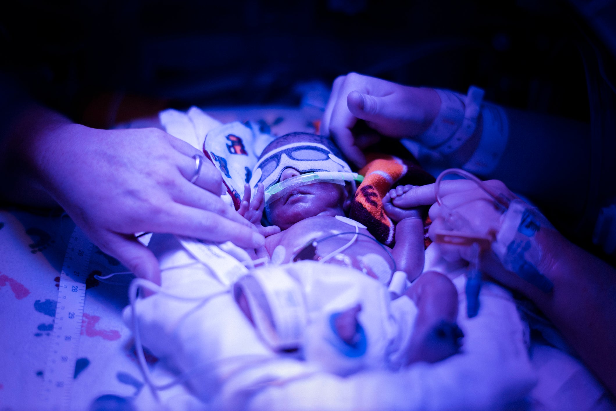premature babies physics youtube minutephysics