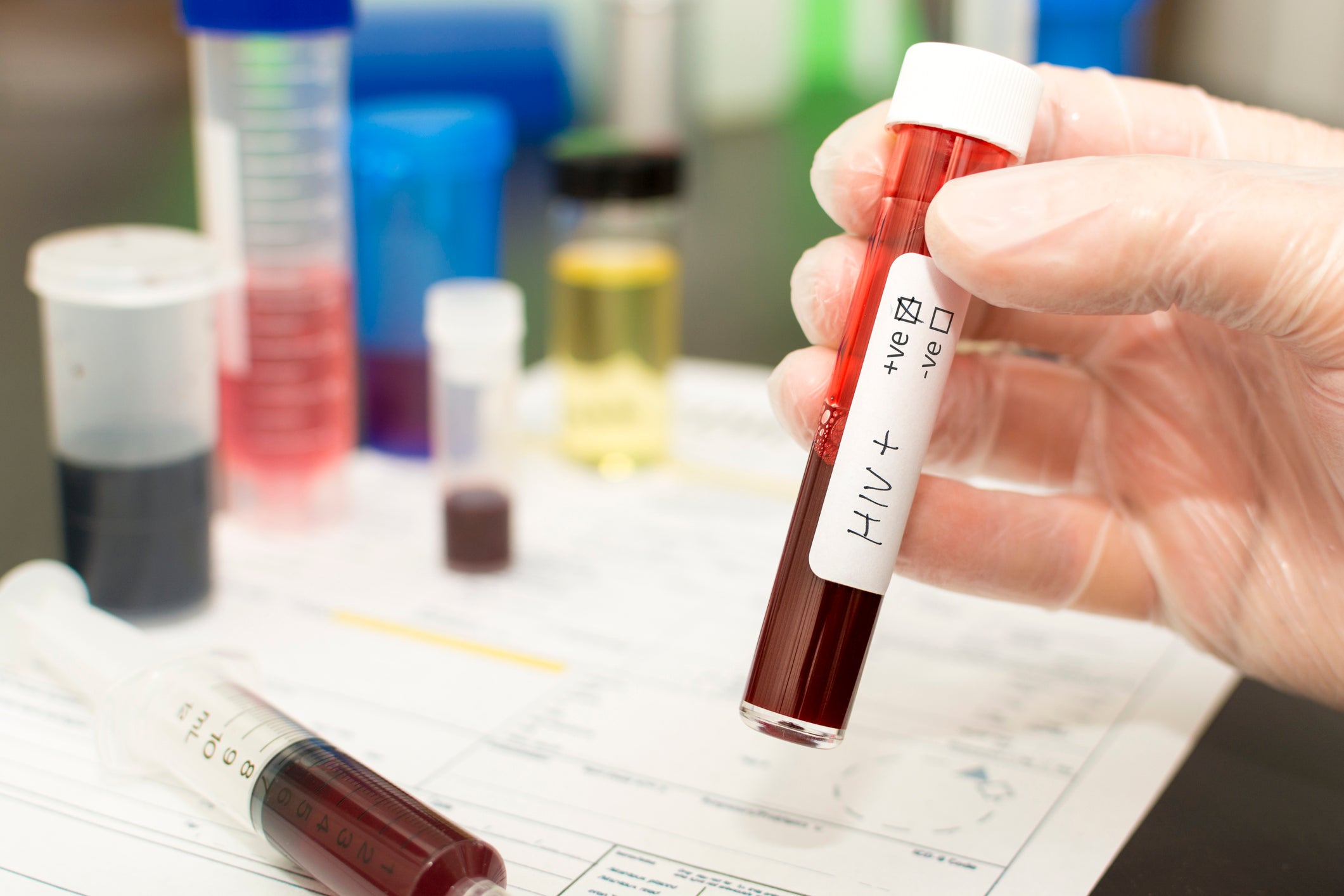 hiv crispr genetic engineering crispr/cas9