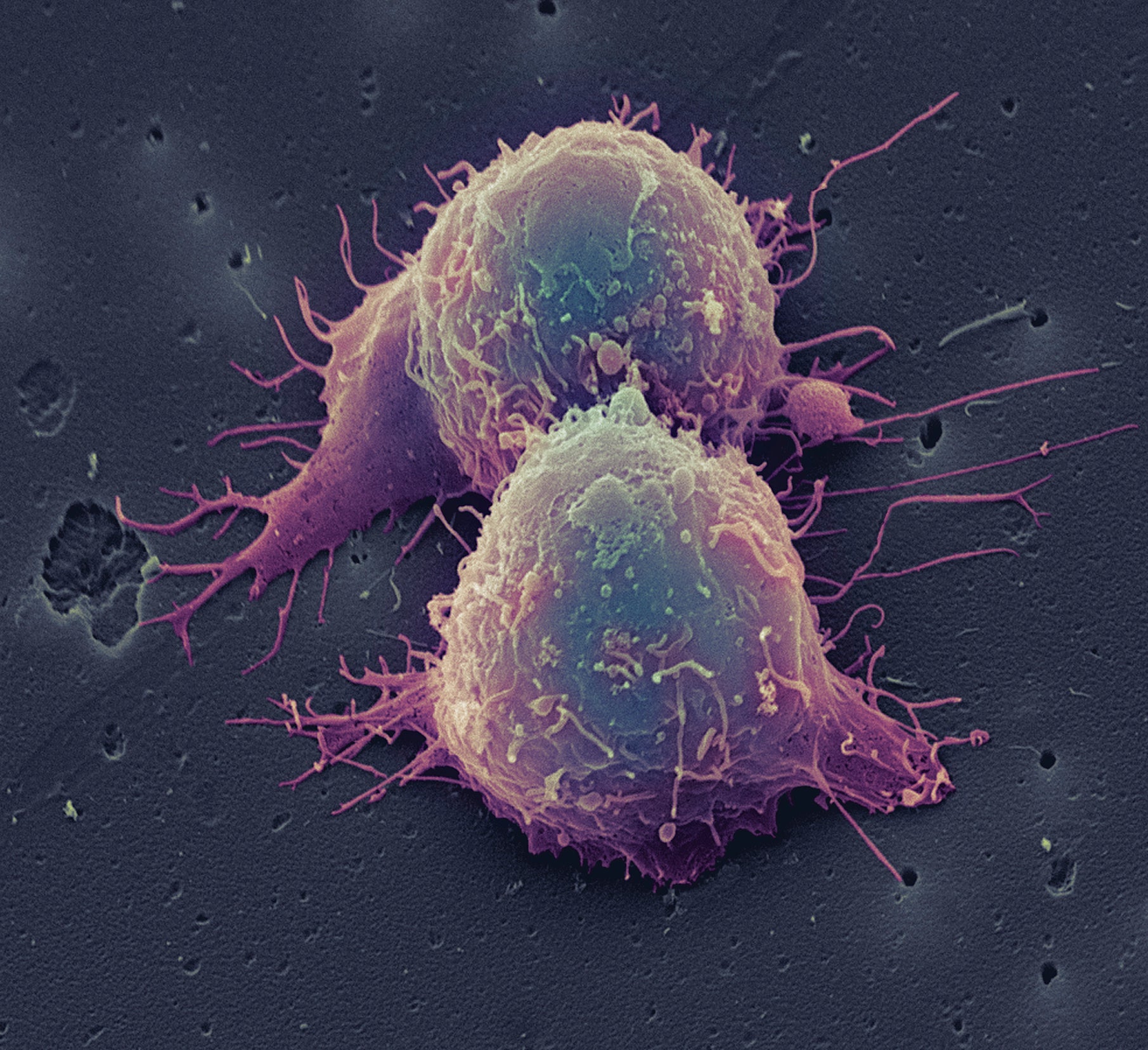 cancer treatment immunotherapy keytruda