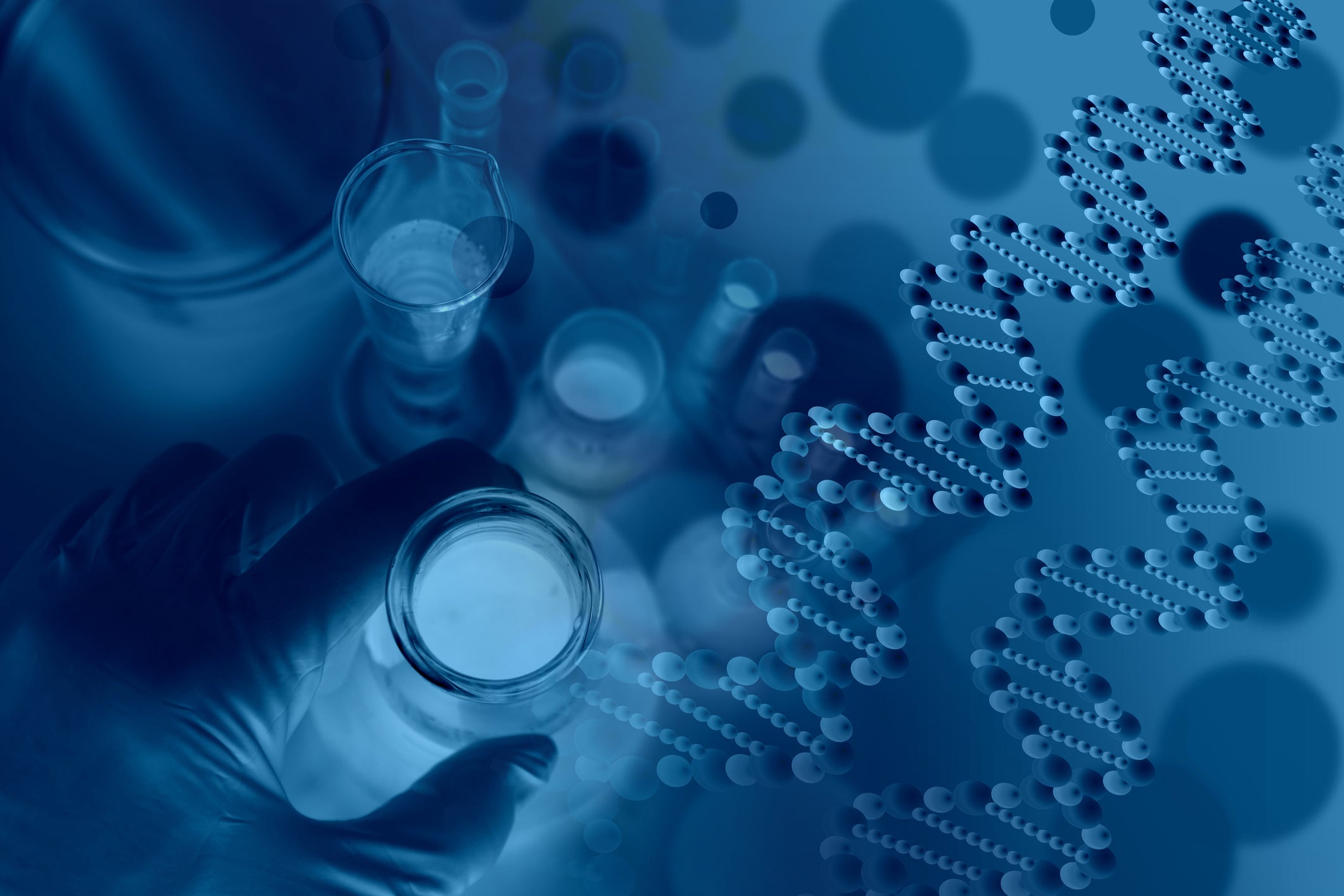 gene therapy strimvelis glybera glaxosmithkline