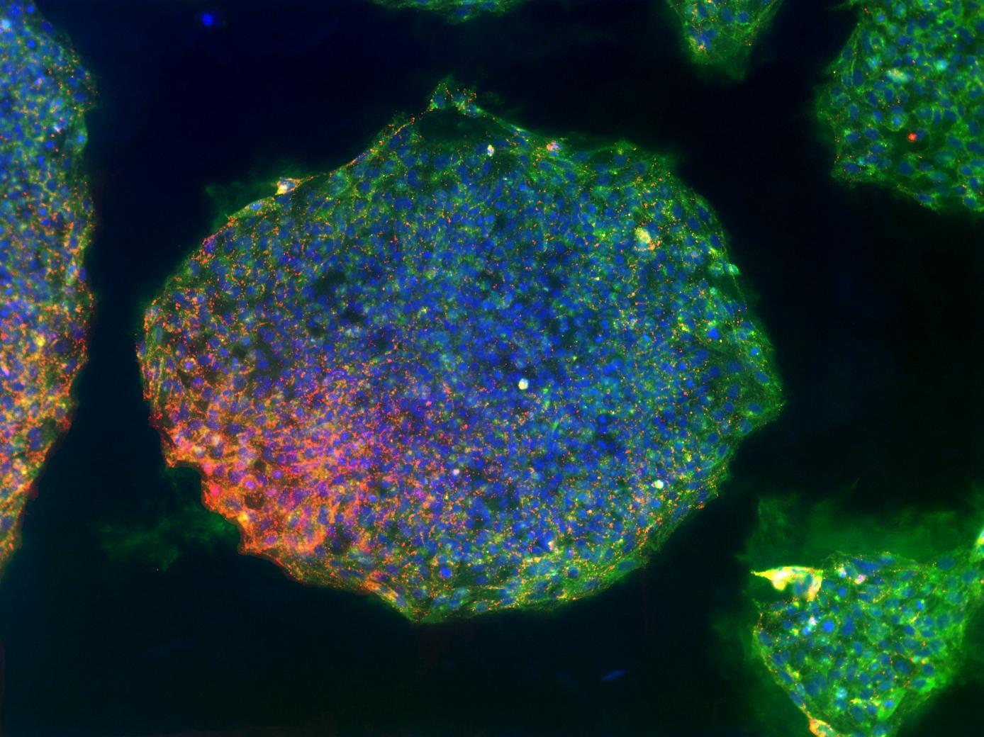 stem cells brain-blood barrier allan-herndon-dudley syndrome ahds
