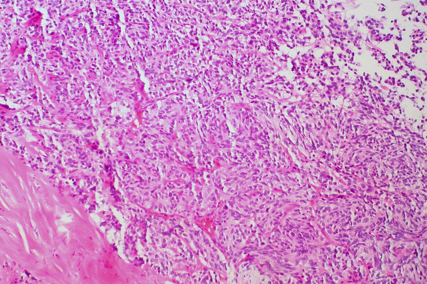 tumors cancer treatment pharmaceutical