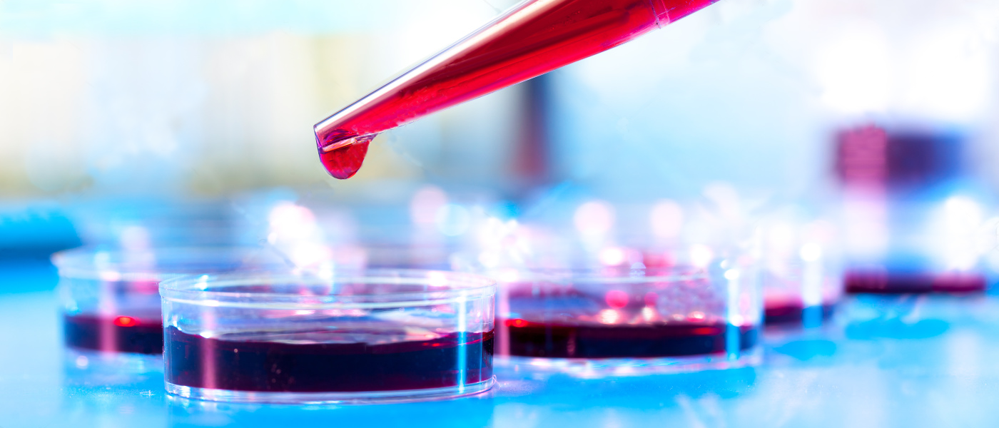 cancer oncology blood test liquid biopsy