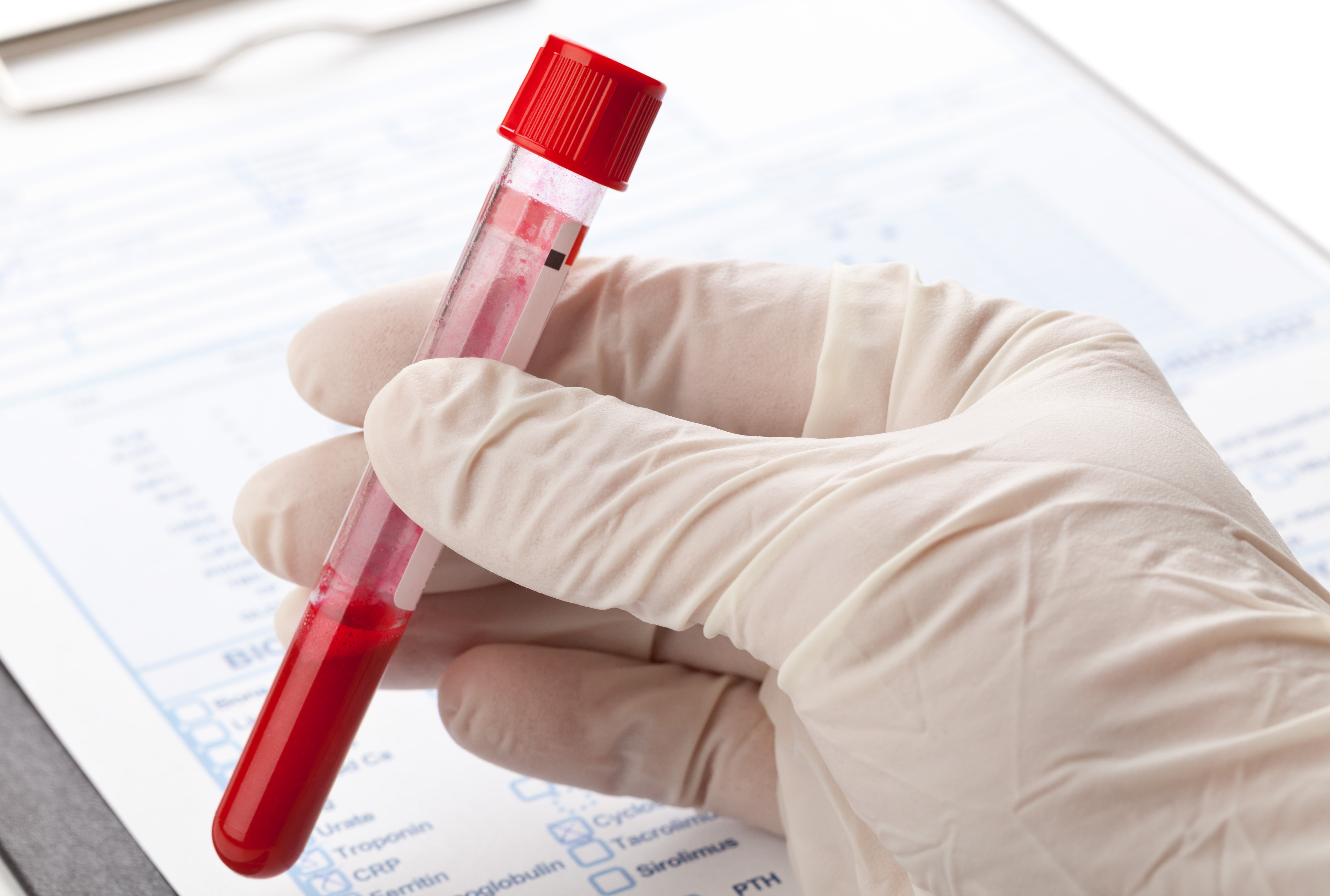 alzheimer's disease blood test lifestyle interventions
