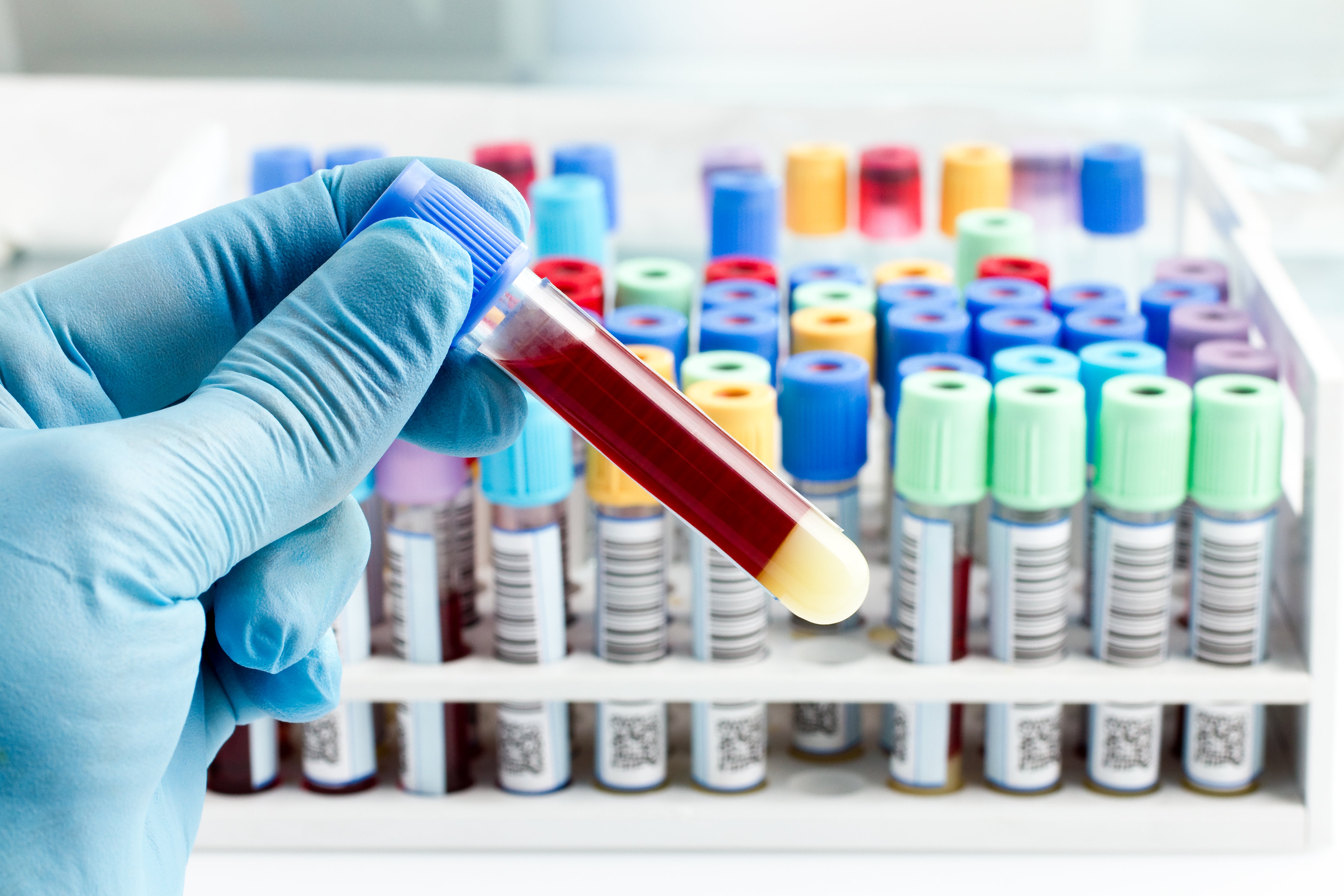 cancer research diagnosis blood test mirna