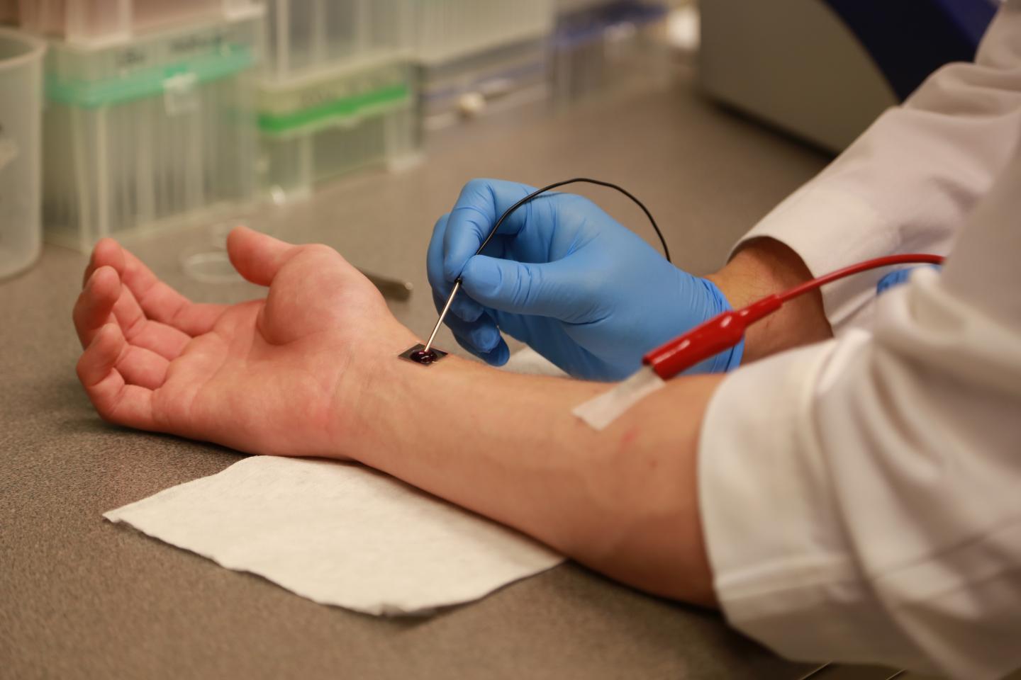tissue nanotransfection cellular reporgramming gene therapy