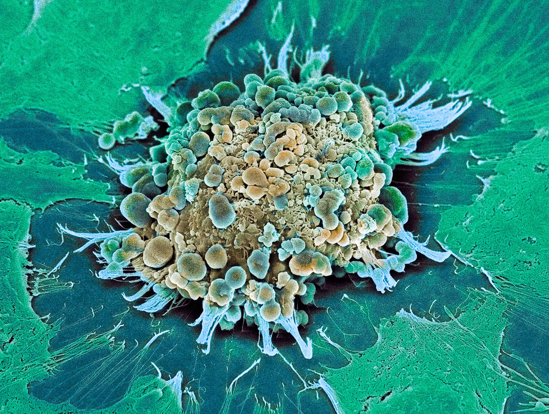 caspase independent cell death cicd