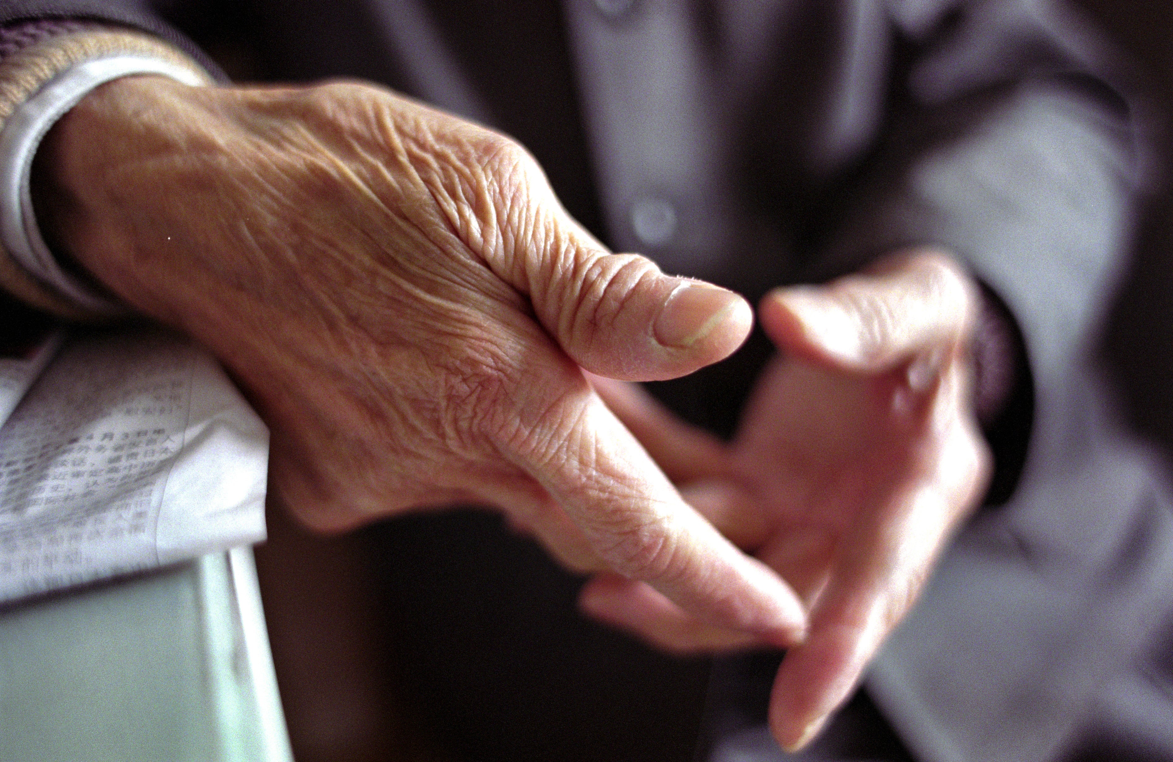 anti-aging progeria cellular aging longevity