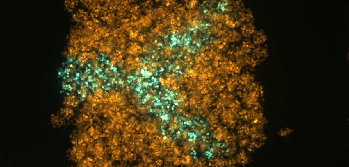 3d bioprinting organ transplants 3d printing lab-grown organs