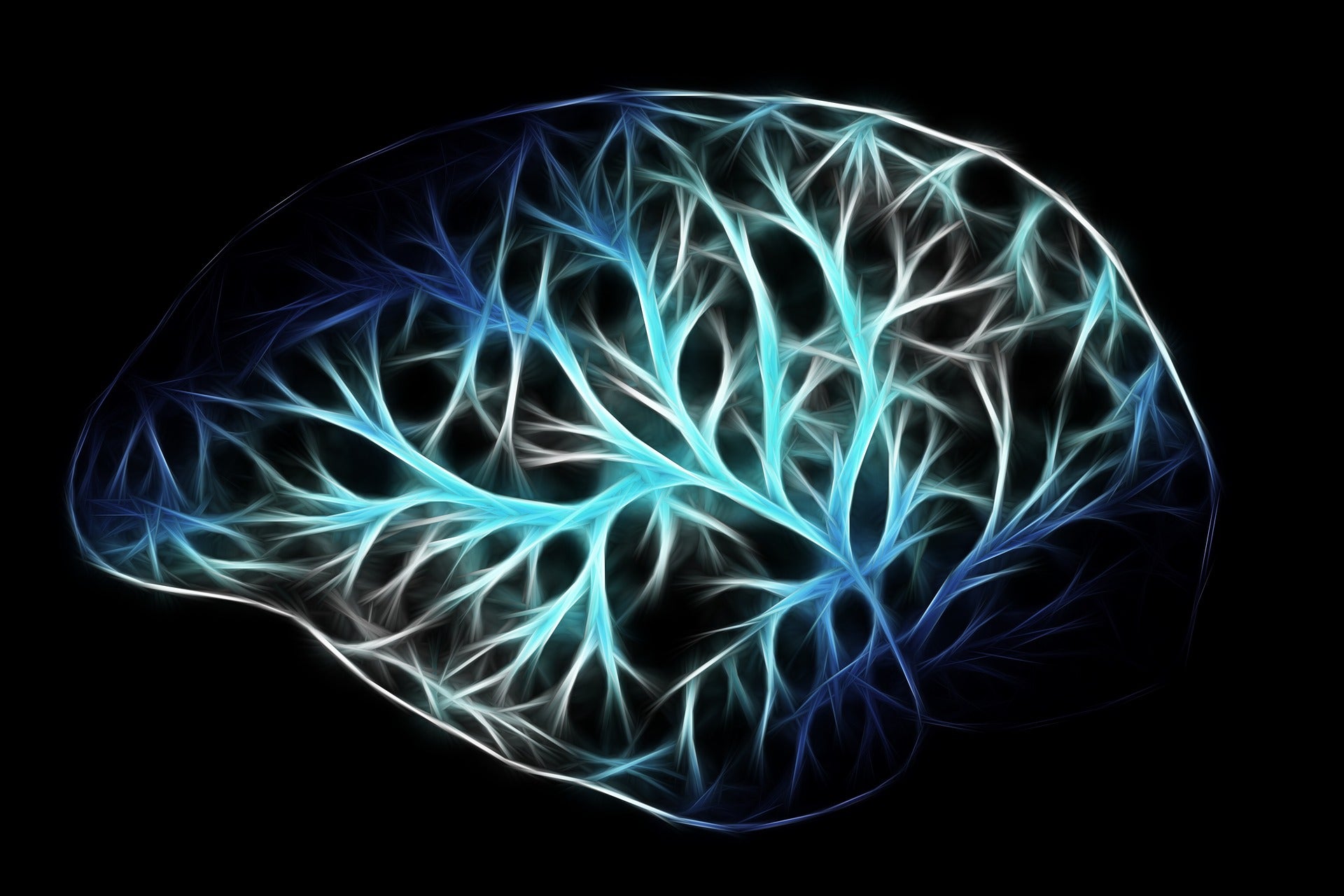 stroke risk mri scanning carotid plaque