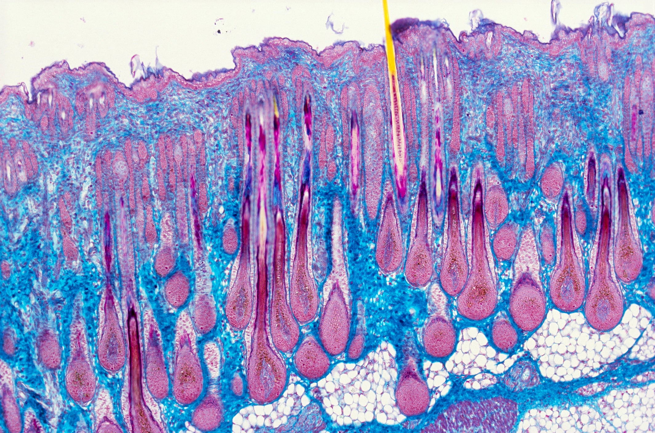neurobiology stem cells motor neurons neurodegenerative diseases