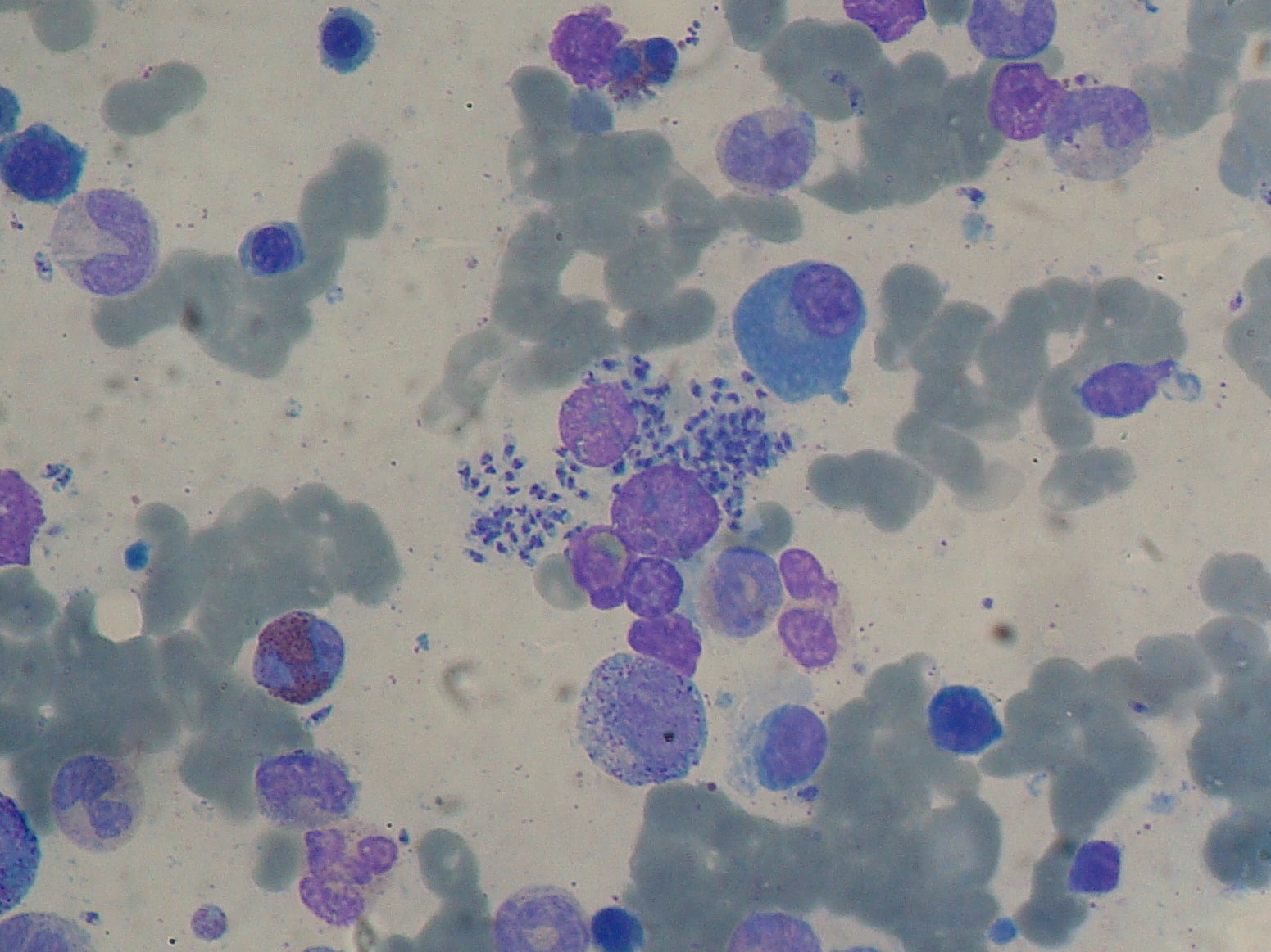 leishmania leishmaniasis climate change vaccine