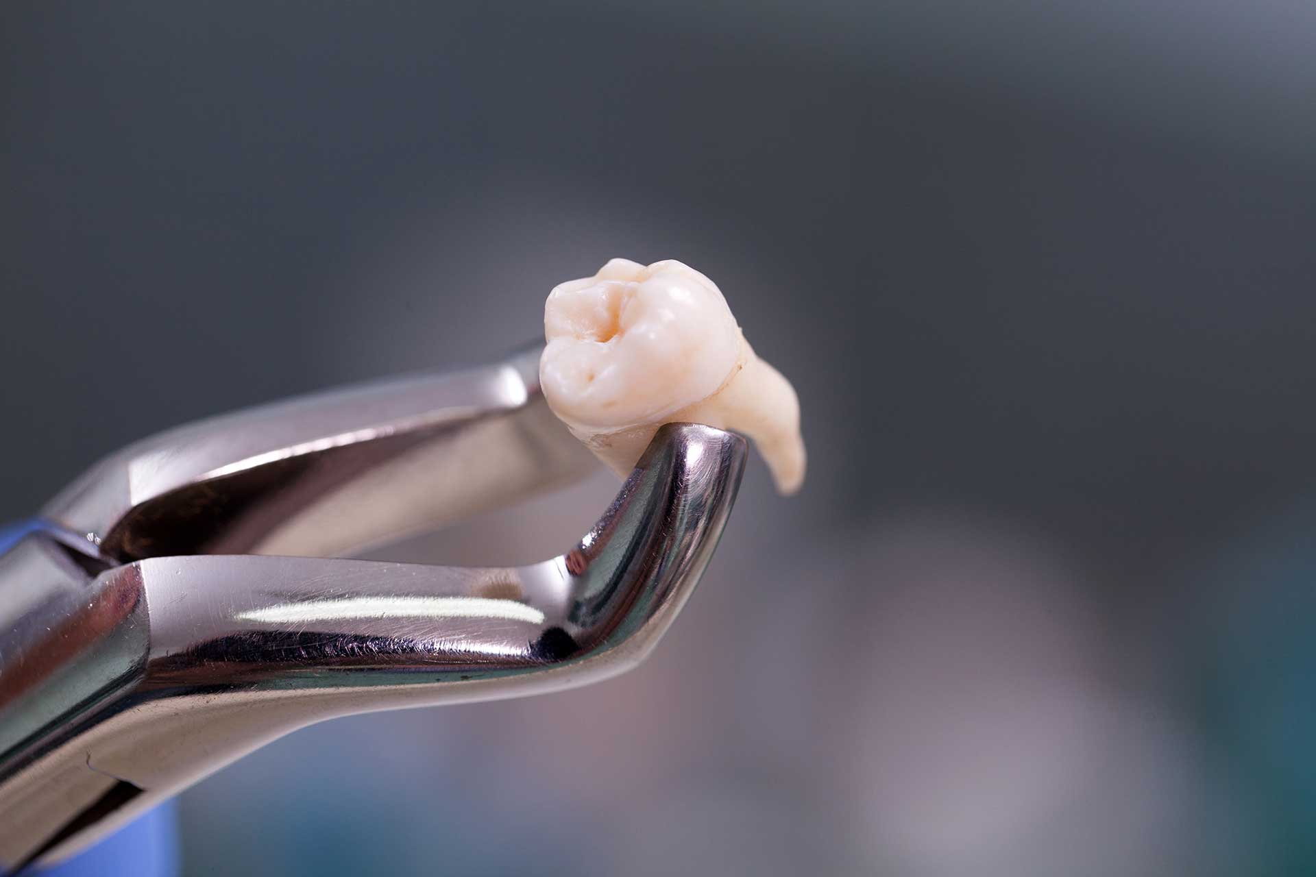 stem cell tooth root pulp tooth cracker 5000