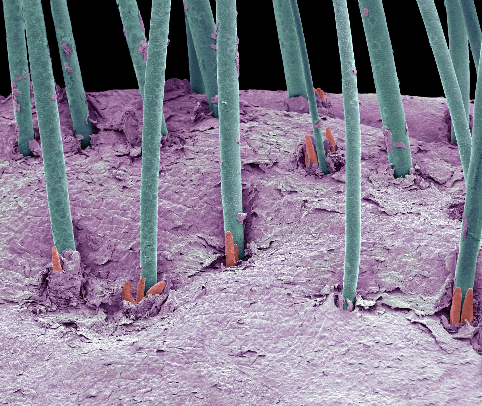 hair baldness alopecia stem cells progenitor cells