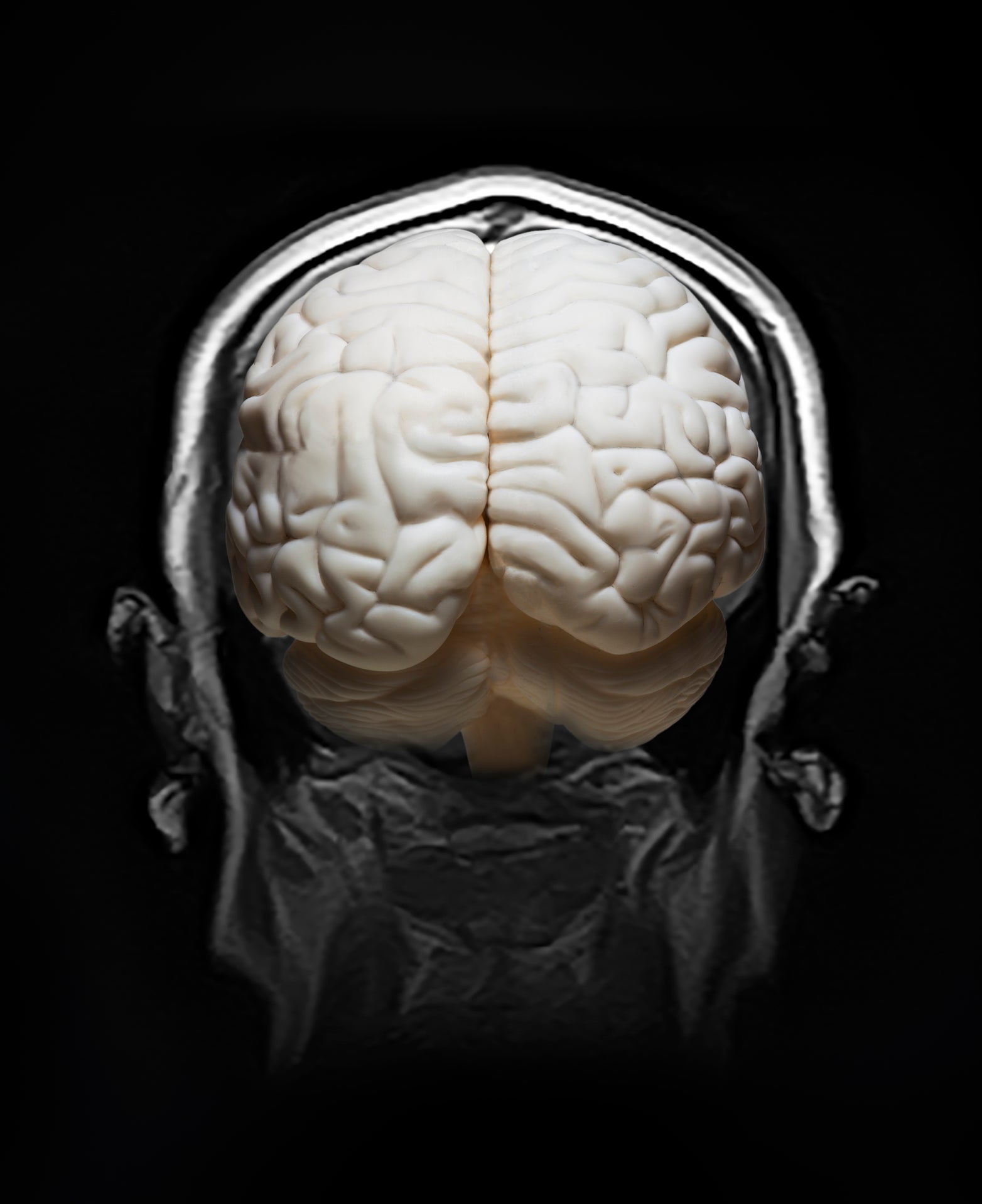 brain stimulation mental health neurobiology memory Brain Device