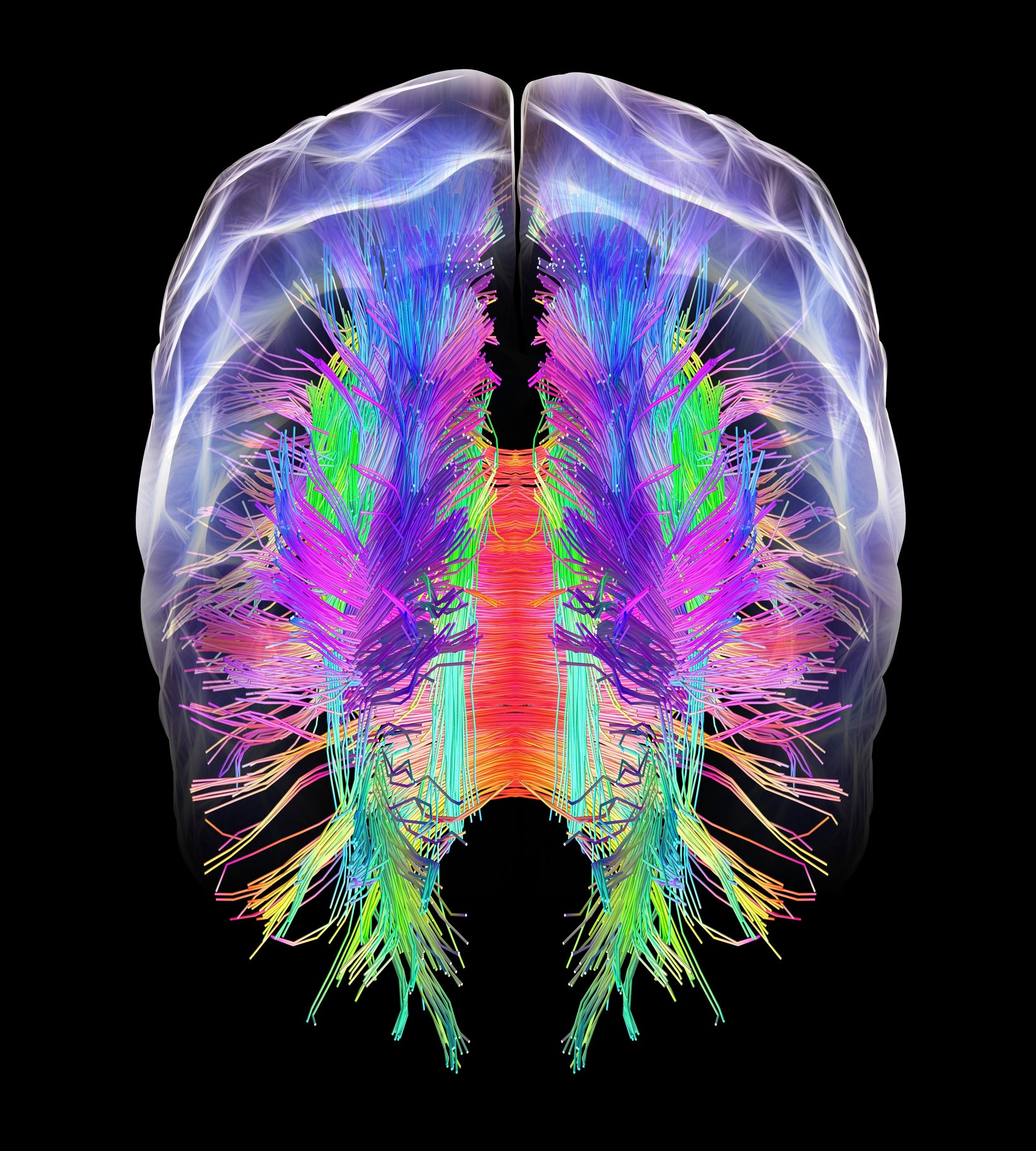 whole-brain map