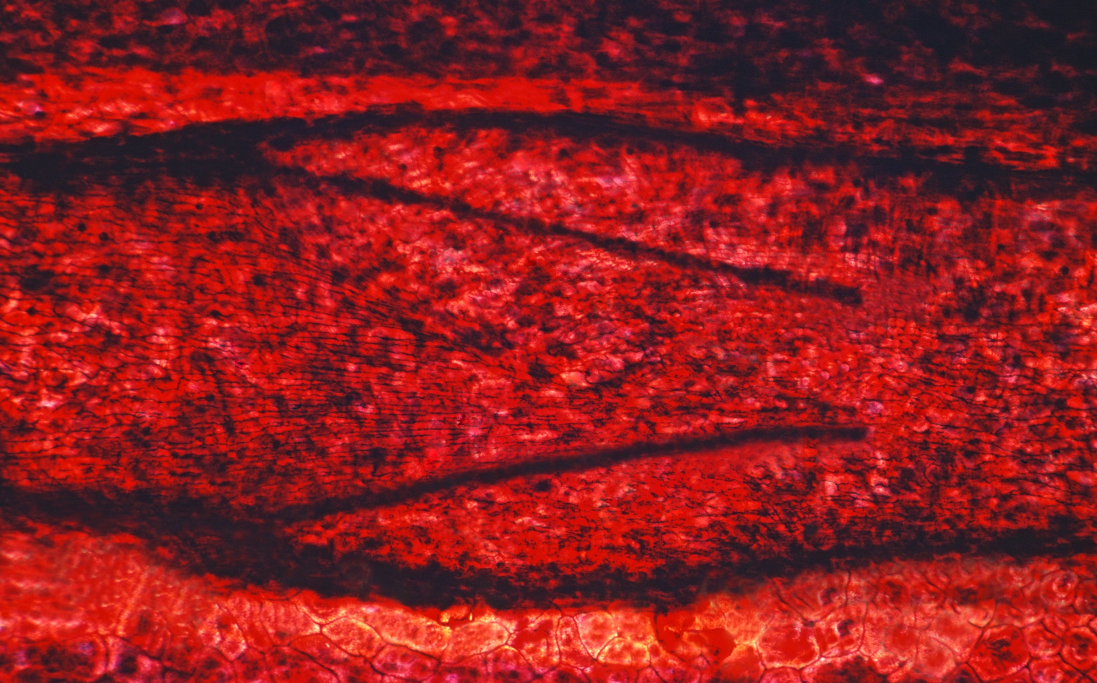 blood vessels ischemia akt r-ras