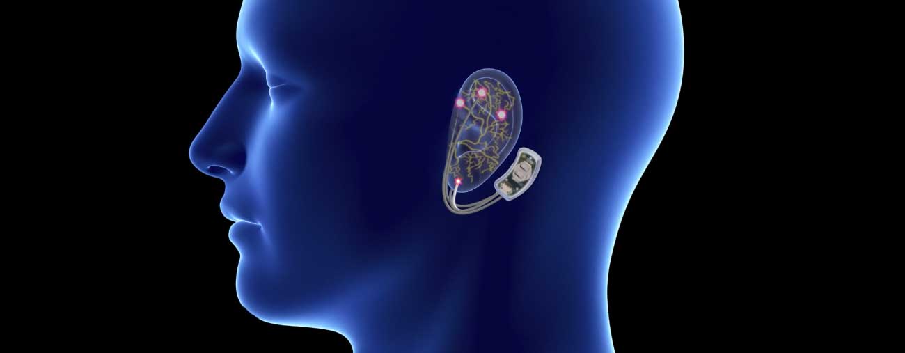 opioid crisis public health neuro-stim system bridge brain stimulation