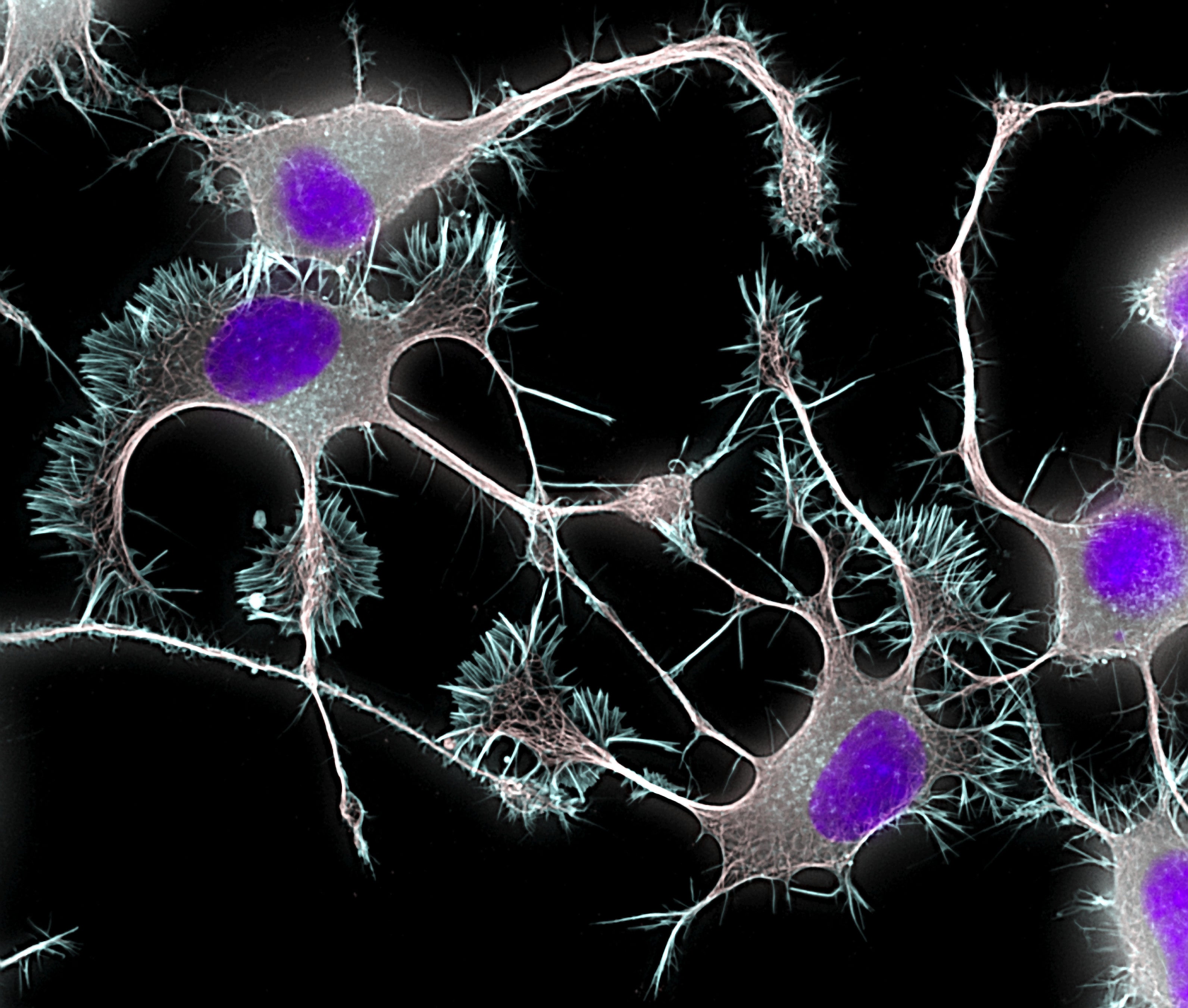 spinal cord injuries