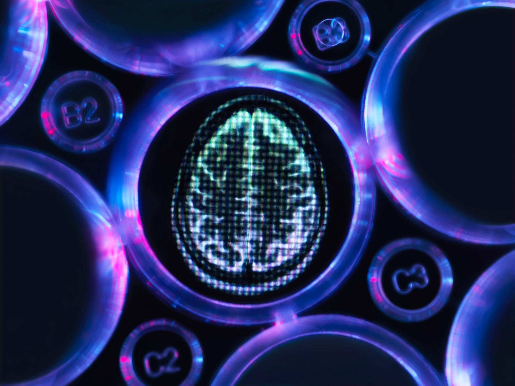 lysosomial storage diseases neuroscience gene therapy