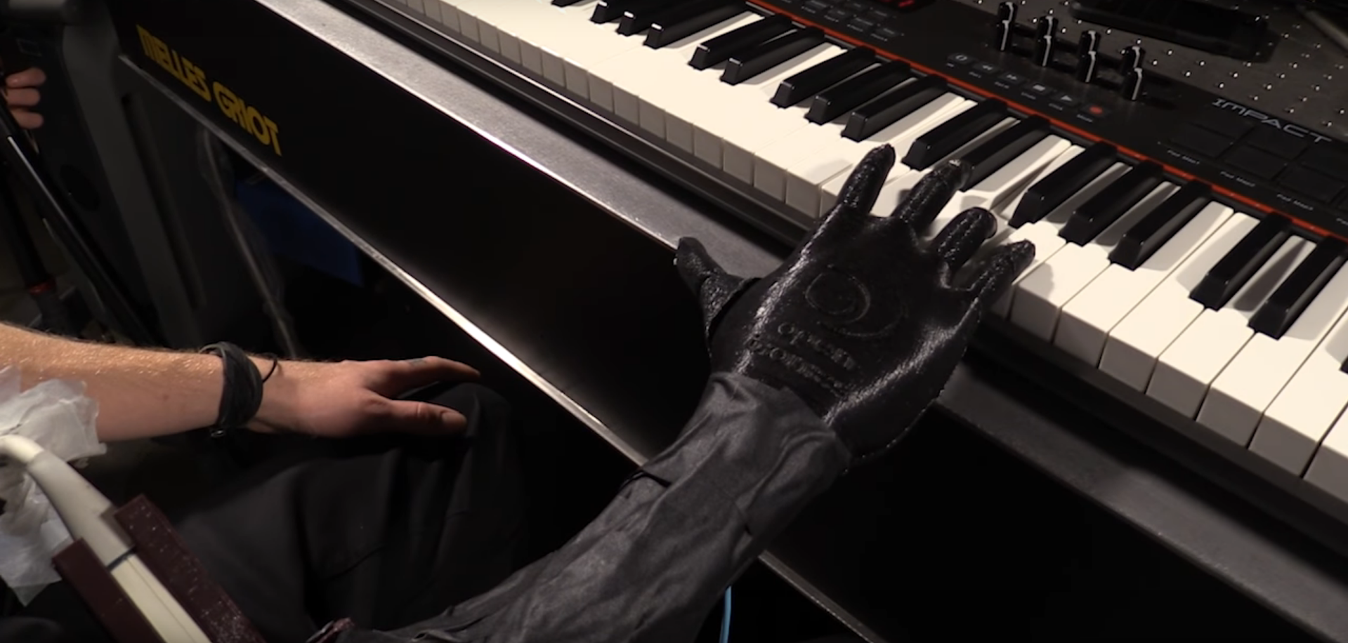 prosthetic amputee robotics ultrasound
