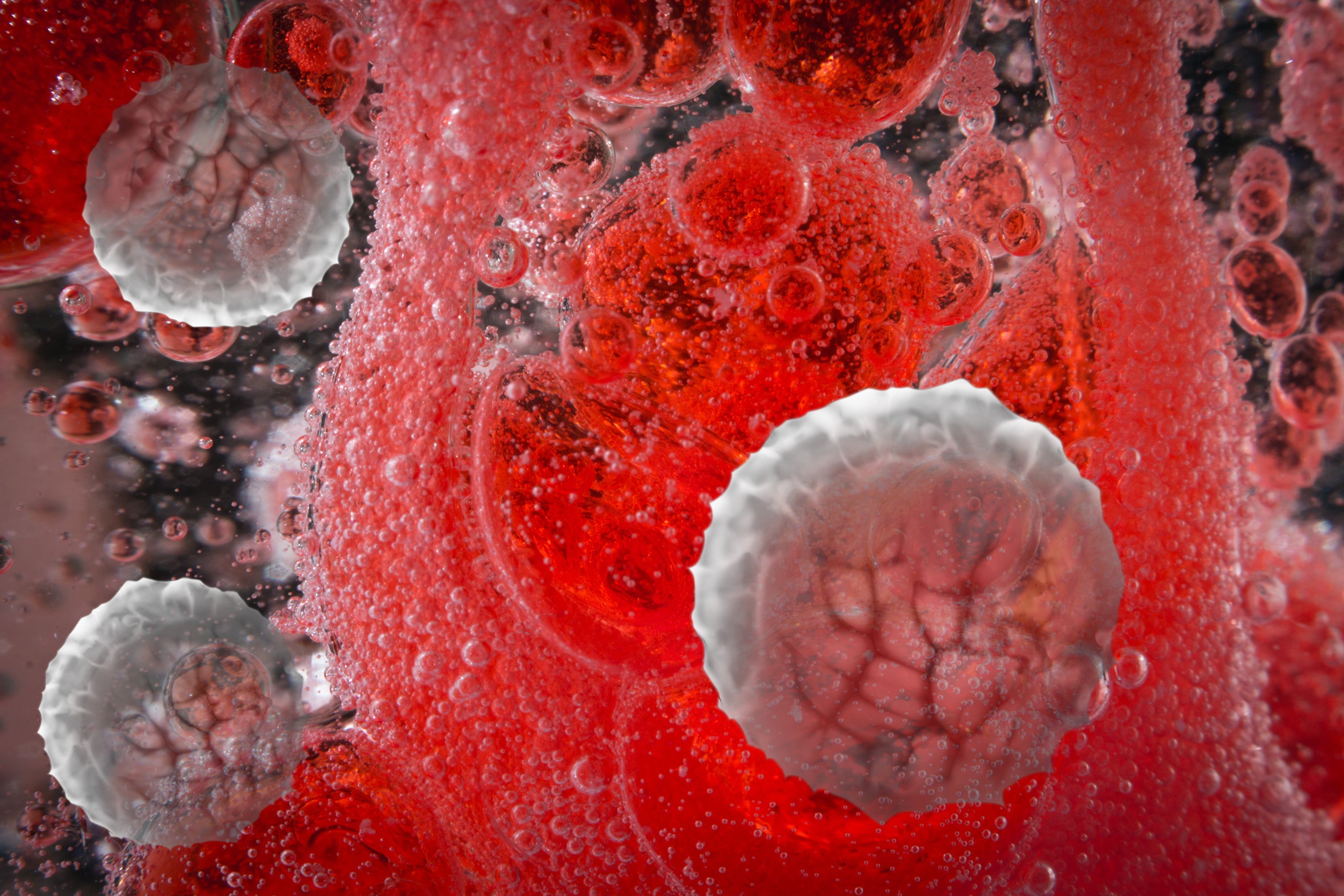 human CRISPR trial