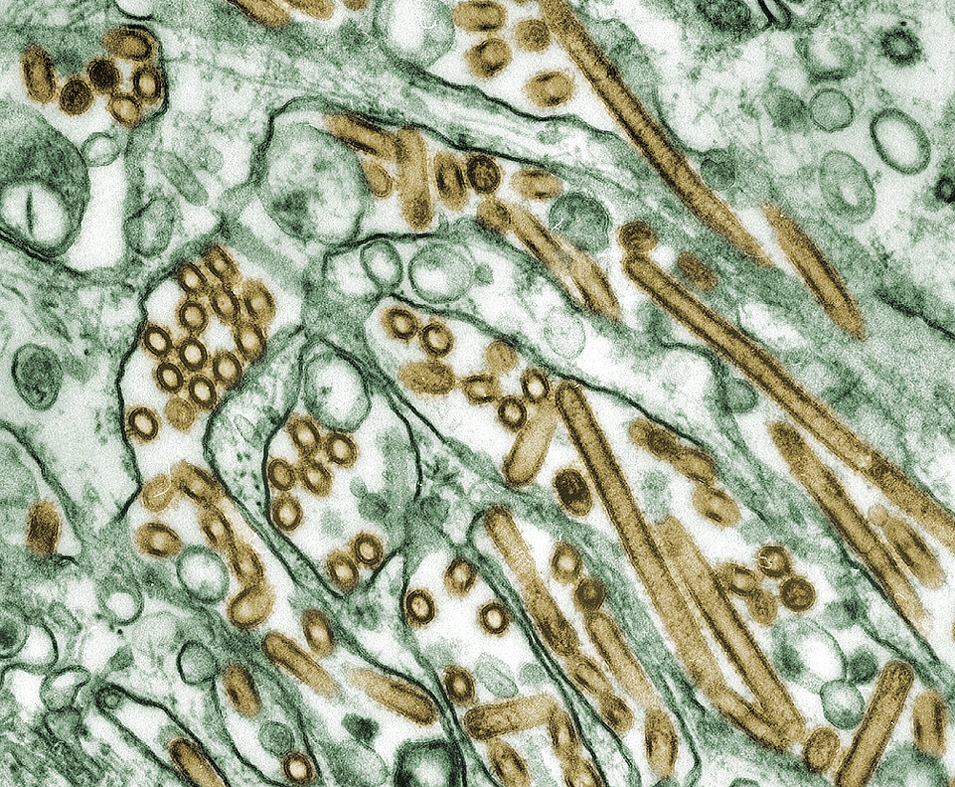 universal vaccine influenza virus flu