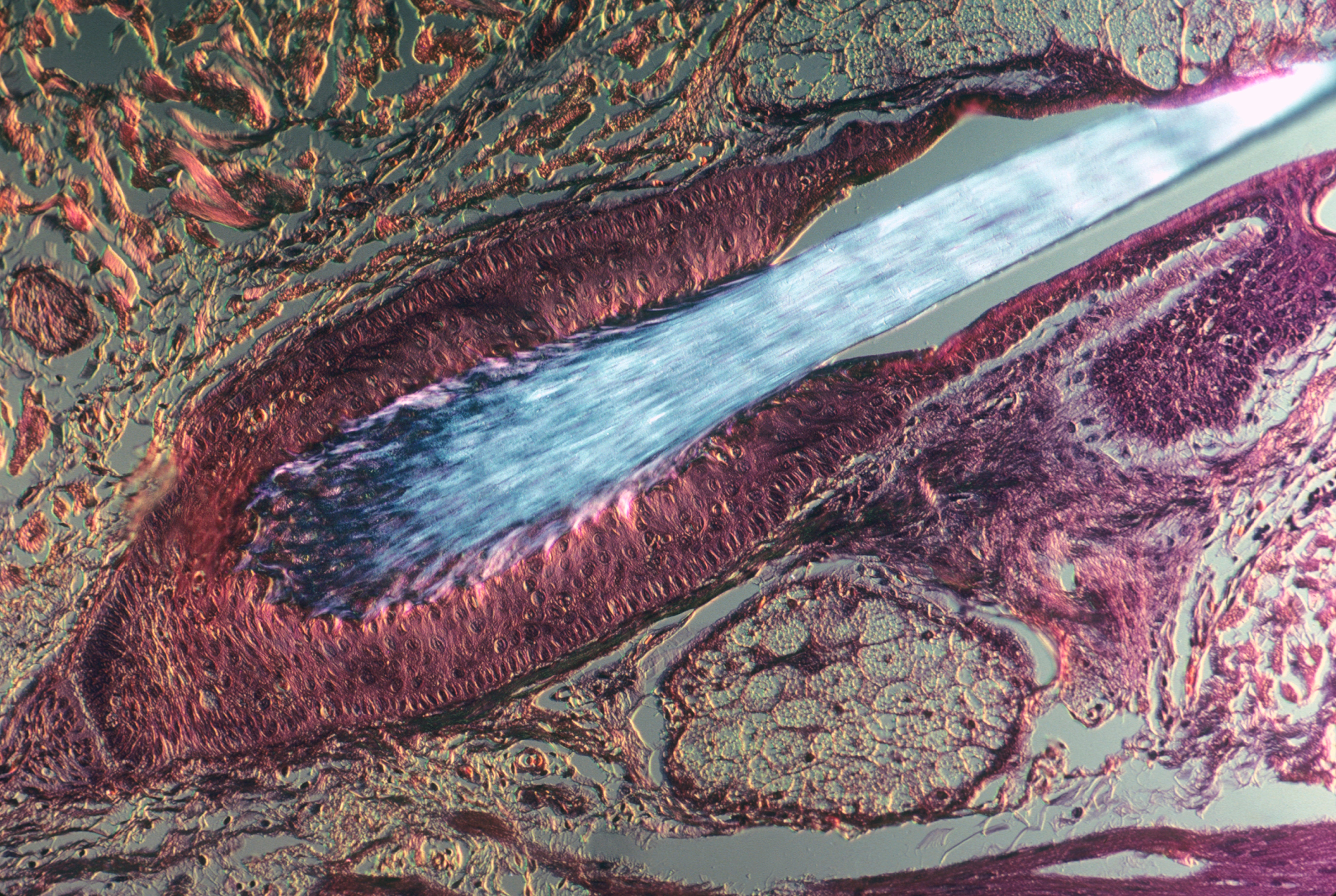 skin stem cells stem cell research skin cancer