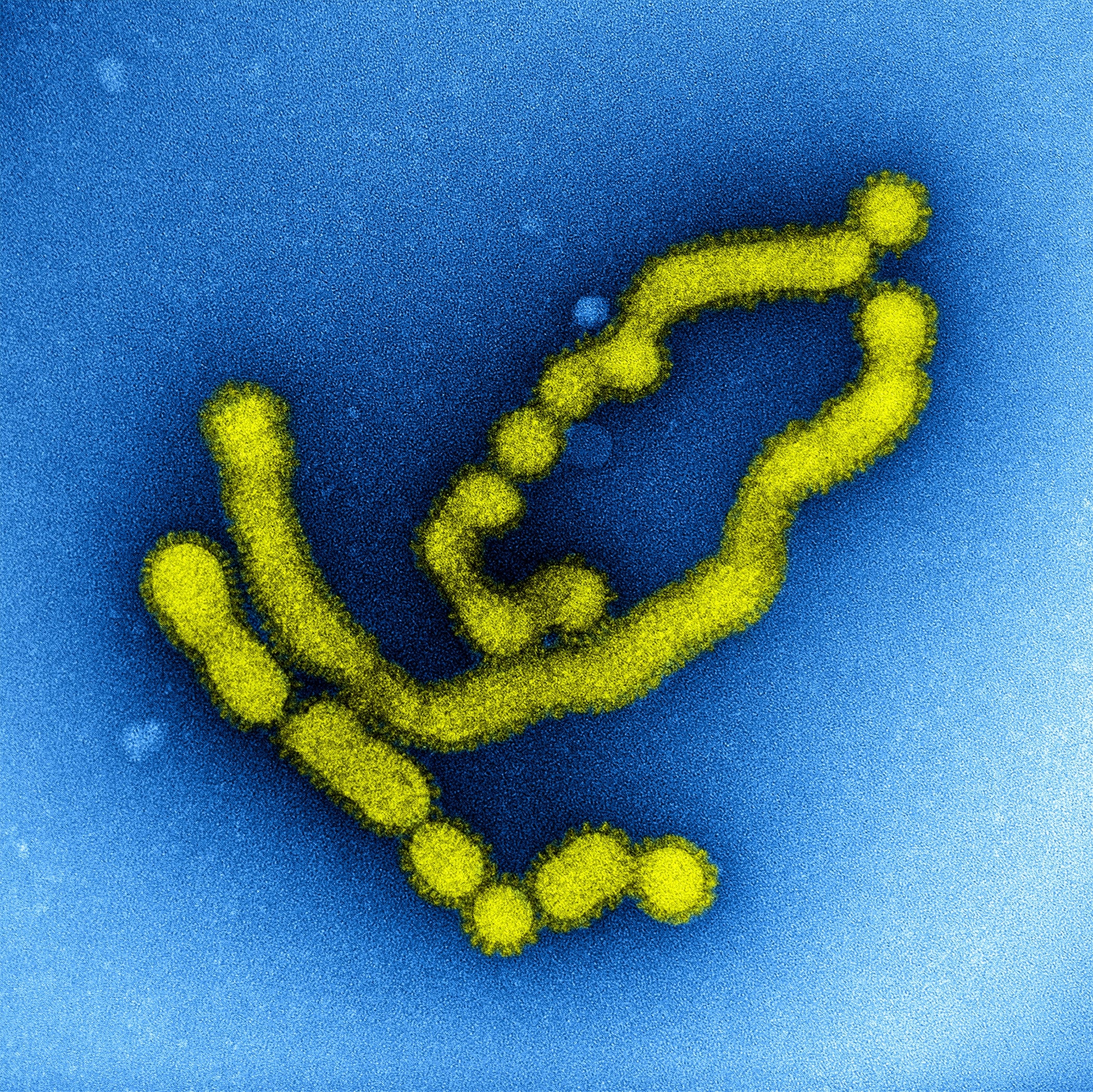 flu vaccine influenza heart attack