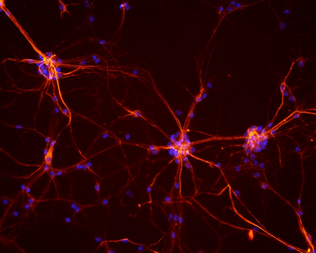 neuroscience neurons anxiety anxiety cells