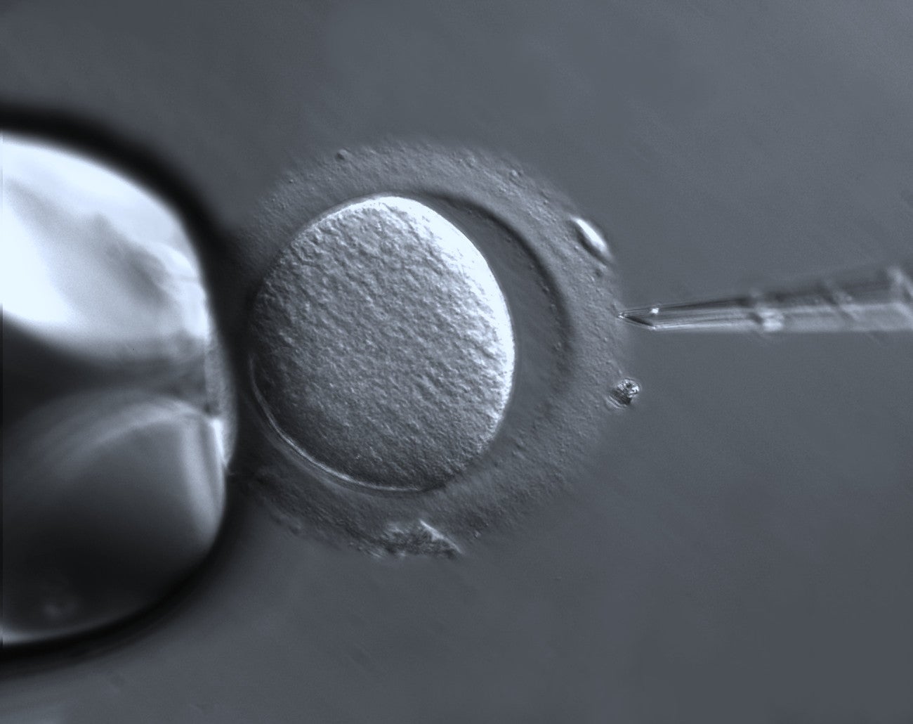 three-parent babies