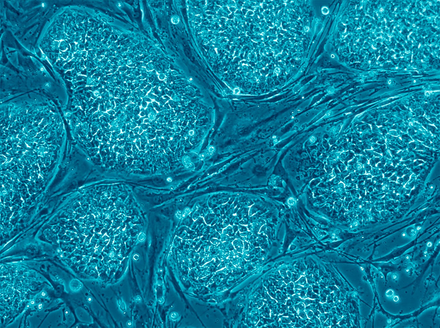 cancer vaccine