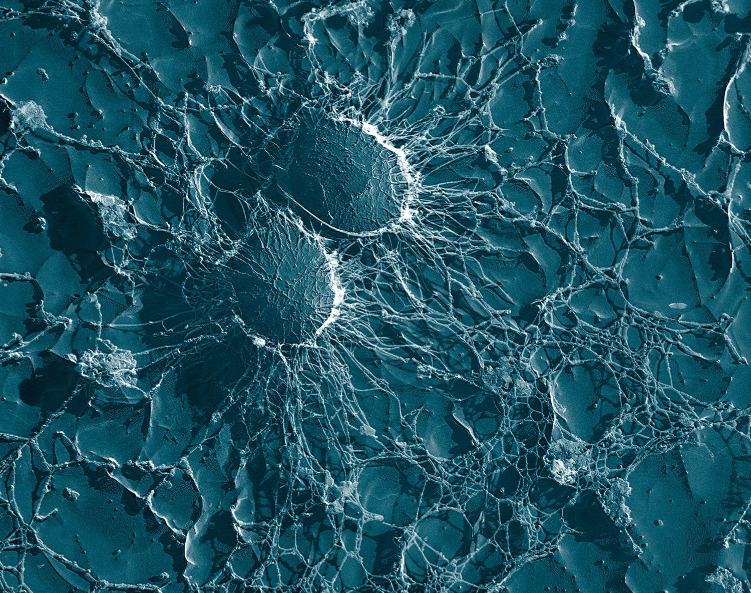 antibiotics antibiotic resistance malacidins