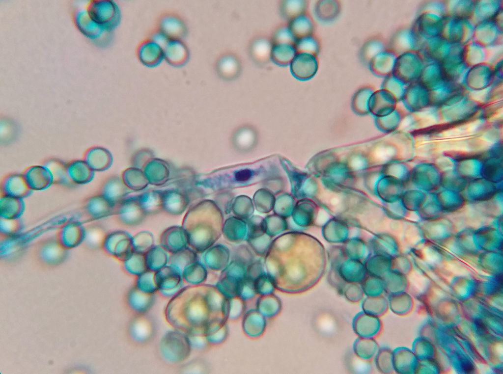 malaria mosquitos africa blue dye treatment